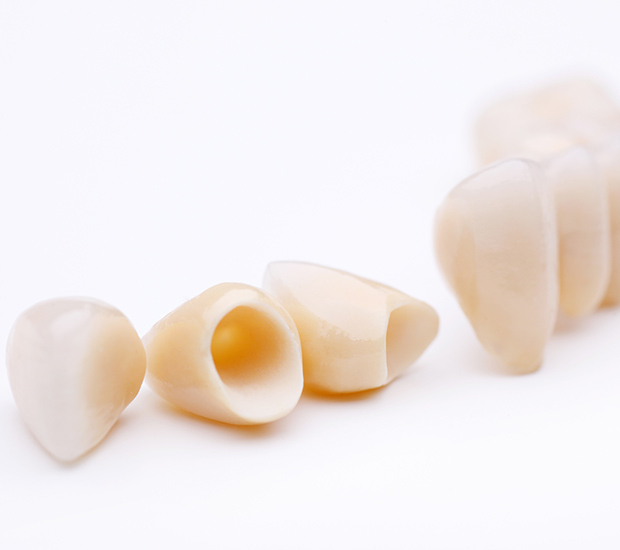 Burbank Dental Crowns and Dental Bridges