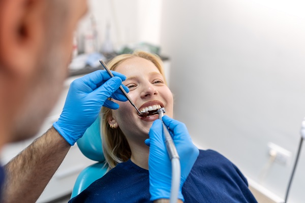 Benefits Of Dental Fillings