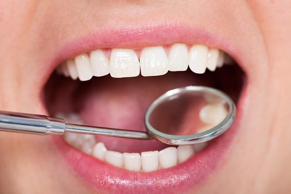 Dental Restoration Options For Damaged Teeth
