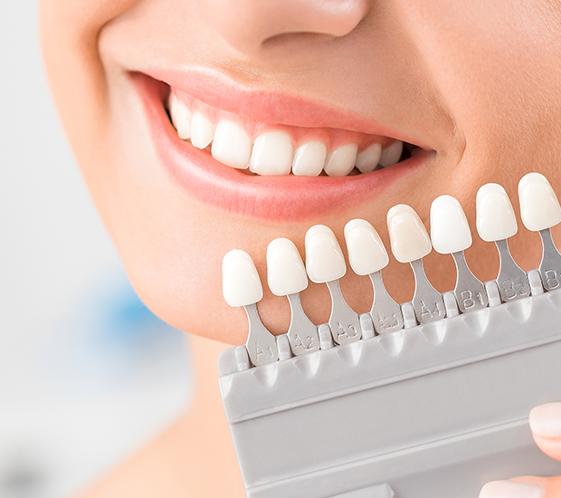 Burbank Dental Veneers and Dental Laminates