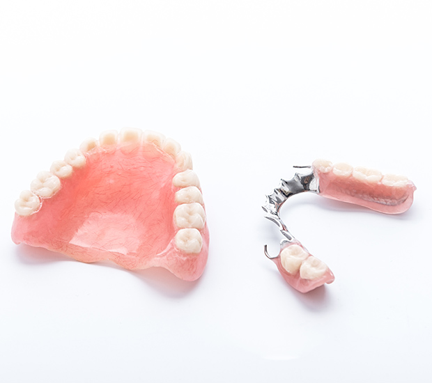 Burbank Partial Dentures for Back Teeth