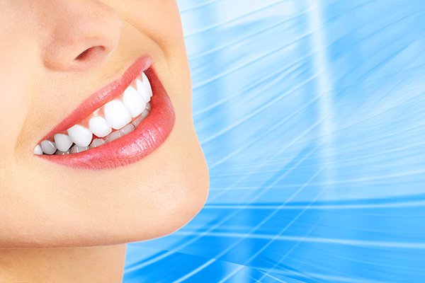 teeth whitening Burbank, CA